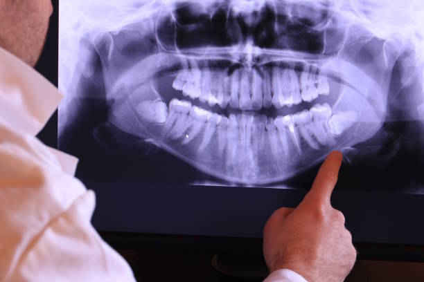 Best Emergency Root Canal Treatment in Kamas, UT