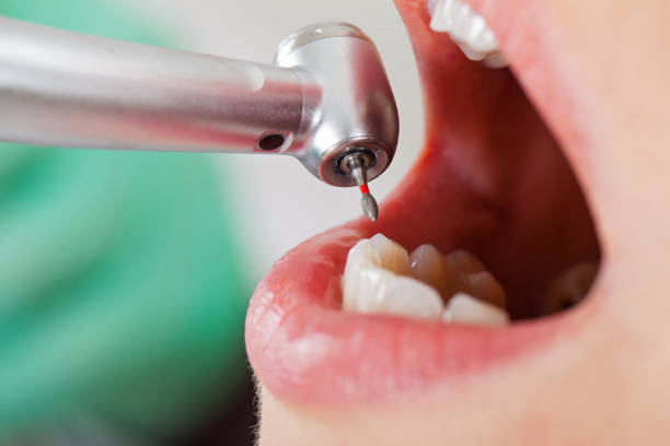 Best Emergency Broken Tooth Repair in Kamas, UT